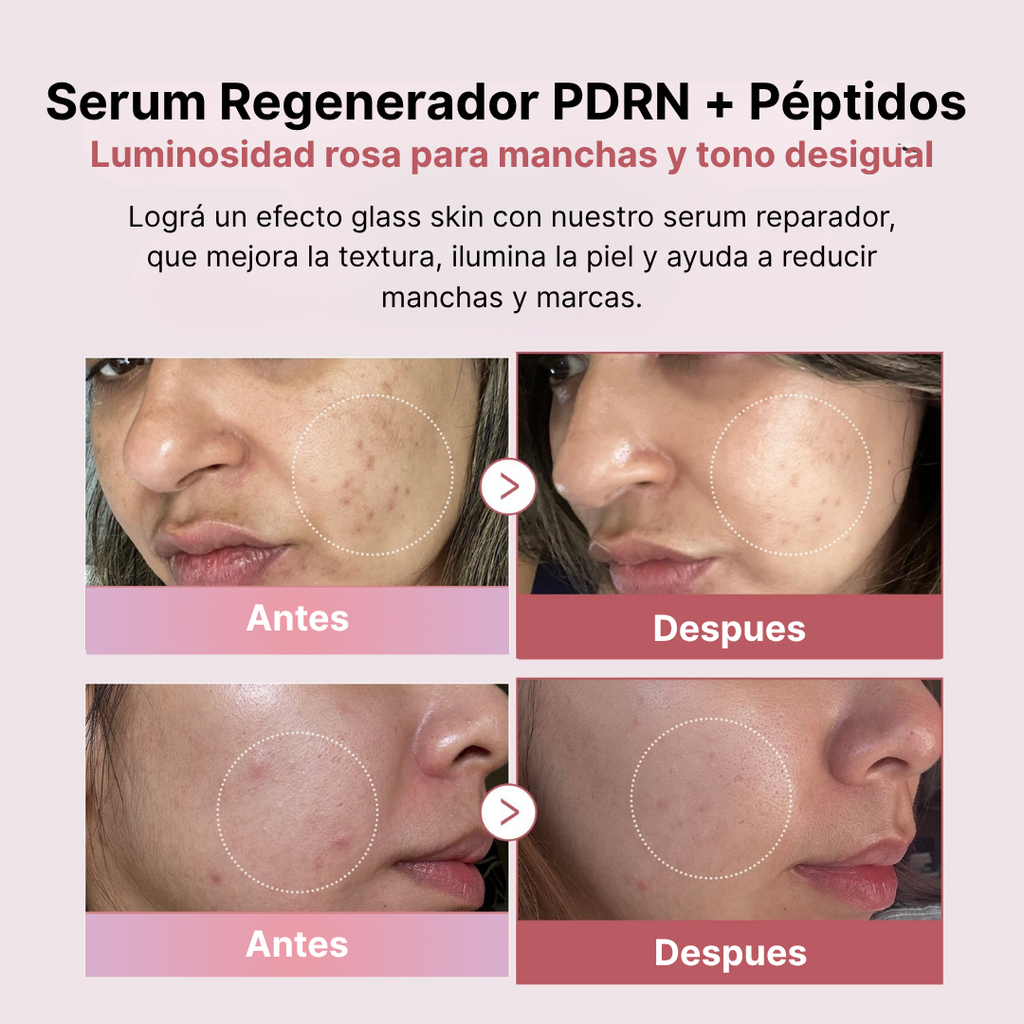 Serum PDRN (Adn de salmon)