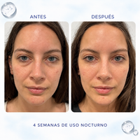 Serum Anti-cansancio para Ojeras Oscuras